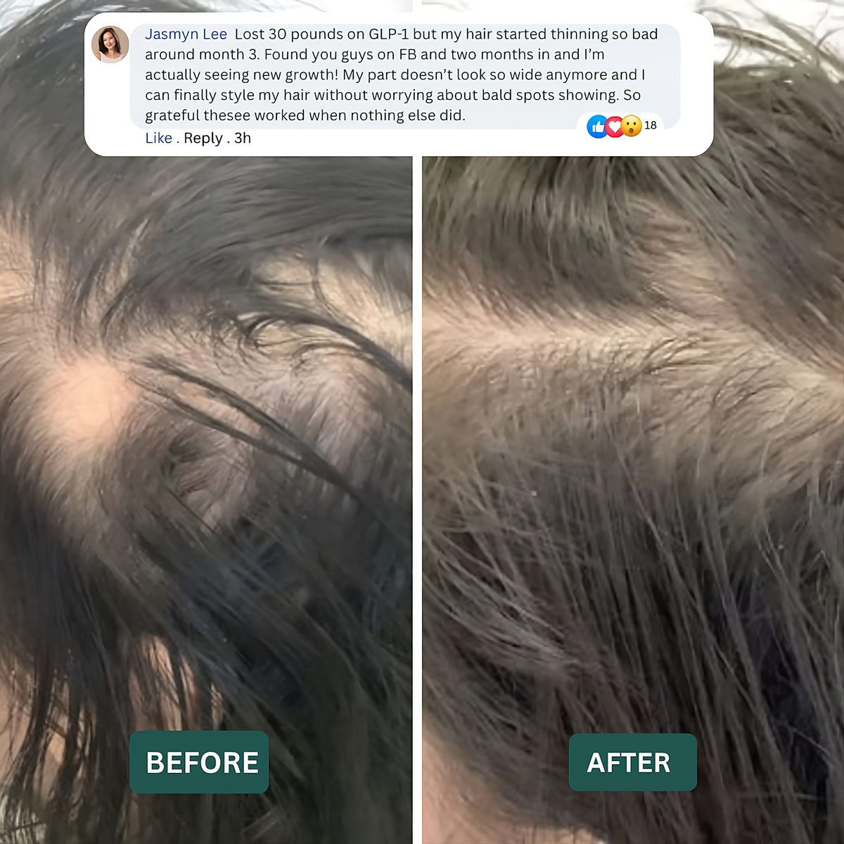 Hair Revive Gummies